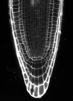 light micrograph of the outline of root cells